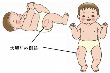 乳幼児接種部位
